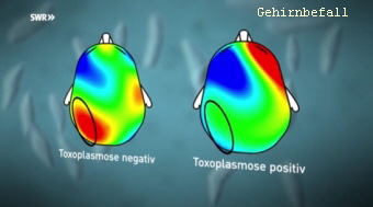 toxo-psyhe